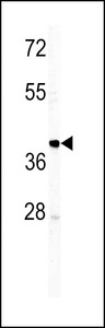 Western blot of IGHM antibody in T47D cell line lysates (35 ug/lane). IGHM (arrow) was detected using the purified antibody.