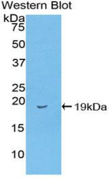 Western blot of recombinant I-FABP / FABP2.