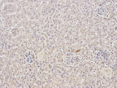 Immunohistochemistry of paraffin-embedded mouse kidney using FABP2 antibody at dilution of 1:100 (200x lens).