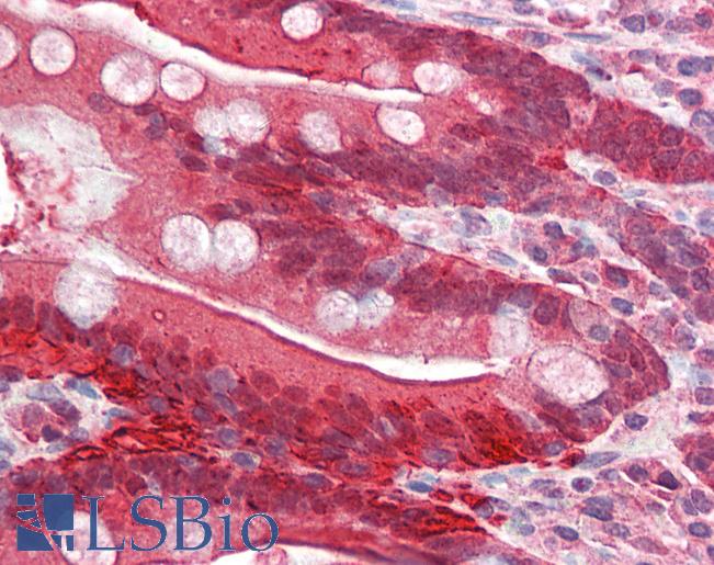 Anti-FABP2 antibody IHC of human small intestine. Immunohistochemistry of formalin-fixed, paraffin-embedded tissue after heat-induced antigen retrieval. Antibody LS-B2397 concentration 5 ug/ml.