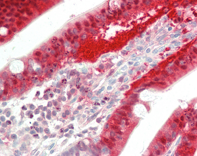 Human Small Intestine: Formalin-Fixed, Paraffin-Embedded (FFPE)