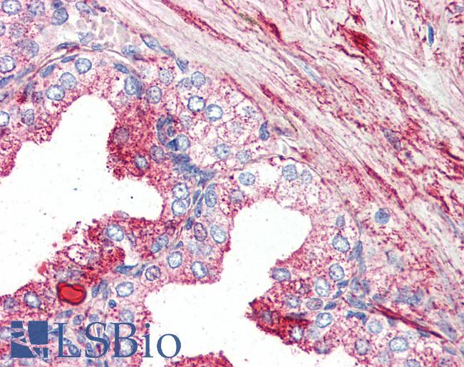 Anti-GPR27 antibody LS-A3682 IHC of human prostate. Immunohistochemistry of formalin-fixed, paraffin-embedded tissue after heat-induced antigen retrieval.