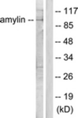 Western blot of extracts from HeLa cells, treated with EGF 200 ng/ml 30', using Amylin Antibody. The lane on the right is treated with the synthesized peptide.