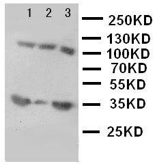 WB of IBSP / Bone Sialoprotein antibody. Lane 1: Rat Liver Tissue Lysate. Lane 2: Rat Brain Tissue Lysate. Lane 3: Rat Kidney Tissue Lysate..