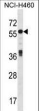 ICA1 Antibody western blot of NCI-H460 cell line lysates (35 ug/lane). The ICA1 antibody detected the ICA1 protein (arrow).