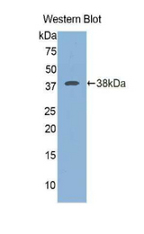 Western blot of recombinant ICA69 / ICA1.