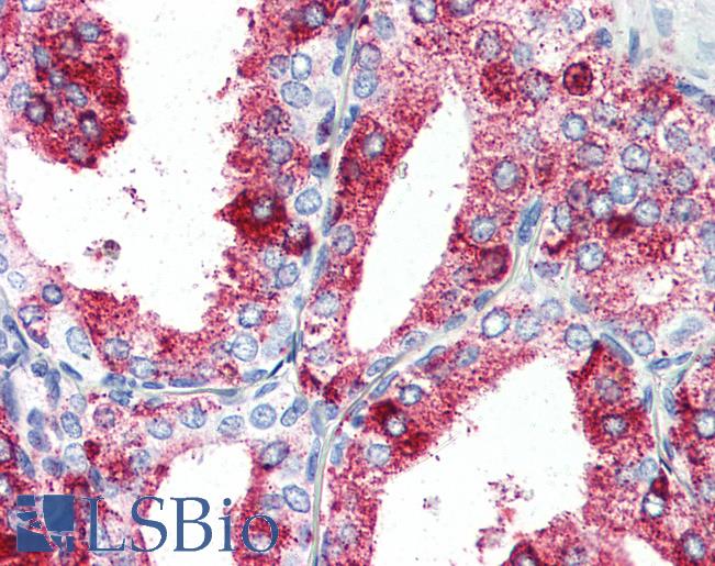 Anti-GPR27 antibody IHC of human prostate. Immunohistochemistry of formalin-fixed, paraffin-embedded tissue after heat-induced antigen retrieval.