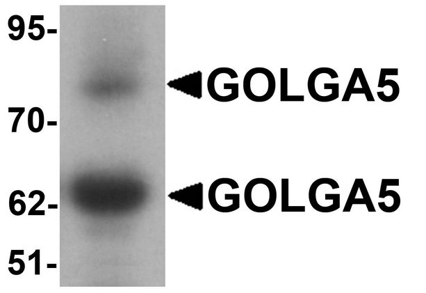 Western blot analysis of GOLGA5 in human testis tissue lysate with GOLGA5 antibody at 1 ug/ml.