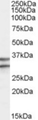 Antibody (0.3 ug/ml) staining of Human Brain (Frontal Cortex) lysate (35 ug protein in RIPA buffer). Primary incubation was 1 hour. Detected by chemiluminescence.
