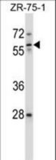 ICAM3 Antibody western blot of ZR-75-1 cell line lysates (35 ug/lane). The ICAM3 antibody detected the ICAM3 protein (arrow).