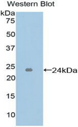 Western blot of recombinant ICAM4 / CD242.