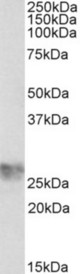 ICAM4 antibody (1 ug/ml) staining of Human Umbilical Cord lysate (35 ug protein in RIPA buffer). Primary incubation was 1 hour. Detected by chemiluminescence.