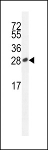 ICOS-S171 western blot of Jurkat cell line lysates (35 ug/lane). The ICOS antibody detected the ICOS protein (arrow).