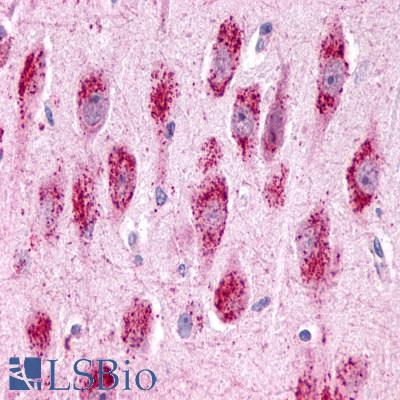 Anti-GPR3 antibody LS-A121 IHC of human brain, neurons and glia. Immunohistochemistry of formalin-fixed, paraffin-embedded tissue after heat-induced antigen retrieval.