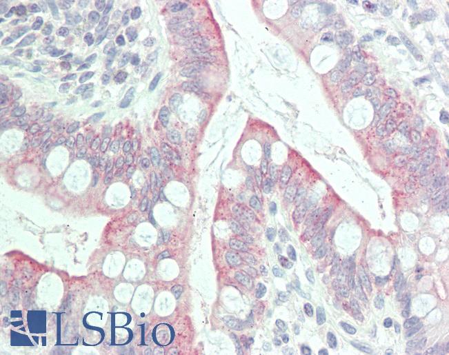 Anti-GPR31 antibody IHC staining of human small intestine. Immunohistochemistry of formalin-fixed, paraffin-embedded tissue after heat-induced antigen retrieval.