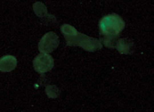 Immunofluorescent staining of PC3 cells with GPR31 antibody (1:100).