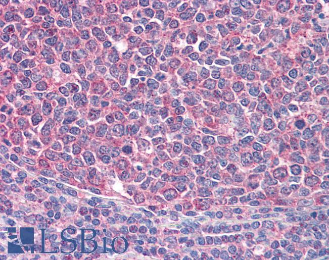 Anti-ICOS antibody IHC of human tonsil. Immunohistochemistry of formalin-fixed, paraffin-embedded tissue after heat-induced antigen retrieval. Antibody LS-B4395 concentration 3.75 ug/ml.