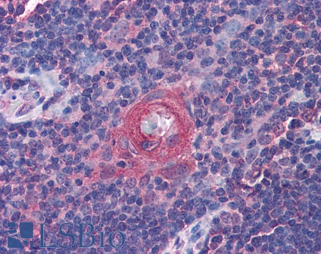 Anti-ICOS antibody IHC of human thymus. Immunohistochemistry of formalin-fixed, paraffin-embedded tissue after heat-induced antigen retrieval. Antibody LS-B4395 concentration 3.75 ug/ml.
