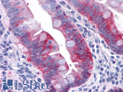 Anti-GPR31 antibody LS-A1158 IHC of human small intestine, epithelium. Immunohistochemistry of formalin-fixed, paraffin-embedded tissue after heat-induced antigen retrieval.