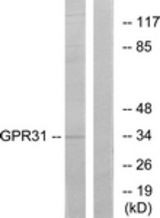Western blot of extracts from COLO cells, using GPR31 Antibody. The lane on the right is treated with the synthesized peptide.