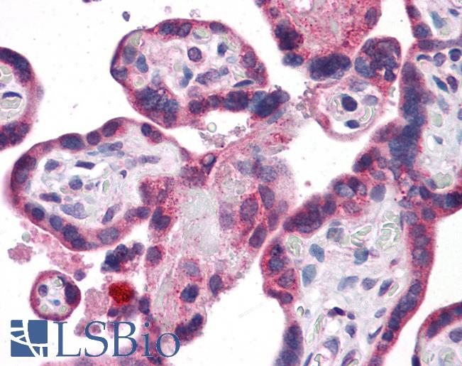 Anti-GPR32 antibody IHC of human placenta. Immunohistochemistry of formalin-fixed, paraffin-embedded tissue after heat-induced antigen retrieval. Antibody LS-B4841 concentration 10 ug/ml.