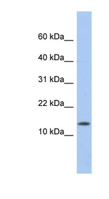 ID2 antibody LS-C102862 Western blot of Fetal Thymus lysate.