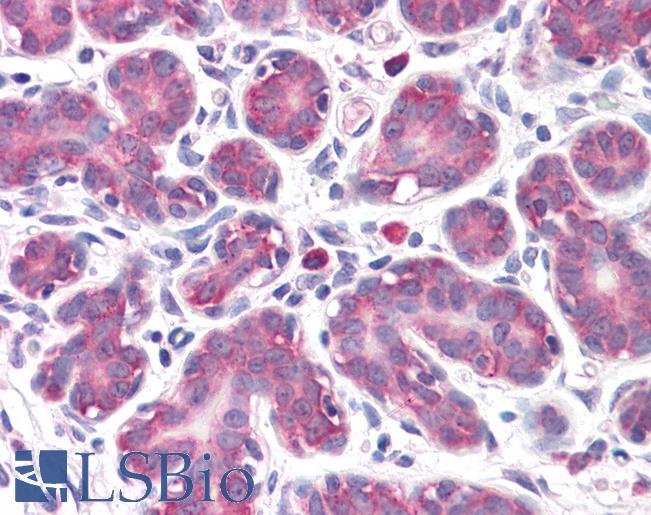 Anti-GPR32 antibody IHC of human breast. Immunohistochemistry of formalin-fixed, paraffin-embedded tissue after heat-induced antigen retrieval. Antibody LS-B4841 concentration 10 ug/ml.