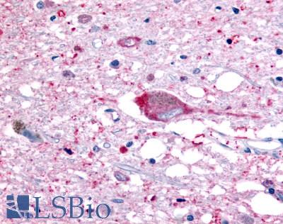 Anti-GPR32 antibody LS-A4889 IHC of human brain, neurons and glia. Immunohistochemistry of formalin-fixed, paraffin-embedded tissue after heat-induced antigen retrieval.