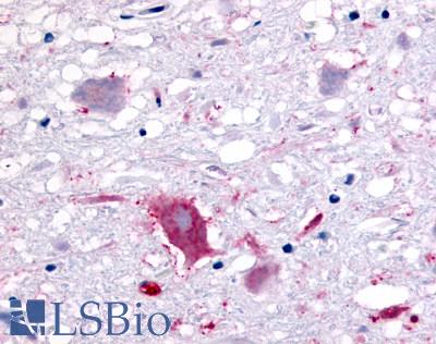 Anti-GPR32 antibody LS-A1680 IHC of human brain, neurons and glia. Immunohistochemistry of formalin-fixed, paraffin-embedded tissue after heat-induced antigen retrieval.