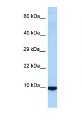 ID3 antibody LS-C146079 Western blot of Rat Liver lysate. Antibody concentration 1 ug/ml.