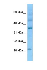 ID3 antibody LS-C146382 Western blot of 293T Cell lysate. Antibody concentration 1 ug/ml.