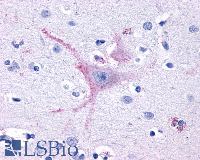 Anti-GPR32 antibody LS-A1678 IHC of human brain, cortex. Immunohistochemistry of formalin-fixed, paraffin-embedded tissue after heat-induced antigen retrieval.