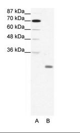 A: Marker, B: HepG2 Cell Lysate