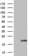 HEK293T cells were transfected with the pCMV6-ENTRY control (Left lane) or pCMV6-ENTRY ID4 (Right lane) cDNA for 48 hrs and lysed. Equivalent amounts of cell lysates (5 ug per lane) were separated by SDS-PAGE and immunoblotted with anti-ID4.