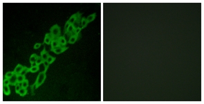 Immunofluorescence of A549 cells, using GPR32 Antibody. The picture on the right is treated with the synthesized peptide.