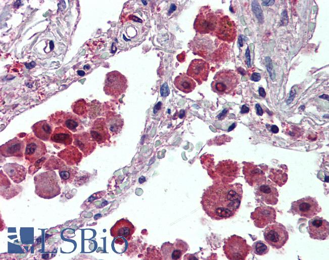 Anti-IDE antibody IHC of human lung. Immunohistochemistry of formalin-fixed, paraffin-embedded tissue after heat-induced antigen retrieval. Antibody LS-B3954 concentration 2.5 ug/ml.