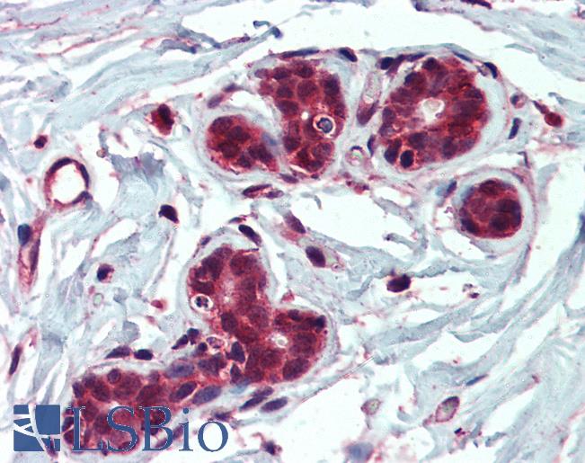 Anti-IDE antibody IHC of human breast. Immunohistochemistry of formalin-fixed, paraffin-embedded tissue after heat-induced antigen retrieval. Antibody LS-B3954 concentration 2.5 ug/ml.