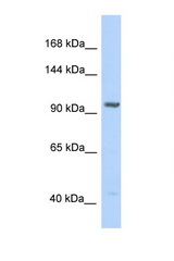 IDE antibody LS-C145525 Western blot of HeLa Cell lysate. Antibody concentration 1 ug/ml.