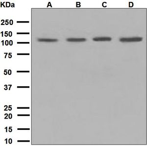 Western blot analysis on (A) Hela, (B) HepG2, (C) A375, and (D) K562 cell lysates using anti-IDE antibody.