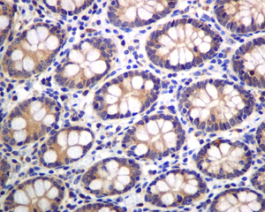 IHC of paraffin-embedded human colon tissue using anti-IDE antibody.