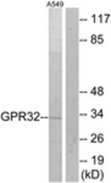 Western blot of extracts from A549 cells, using GPR32 Antibody. The lane on the right is treated with the synthesized peptide.