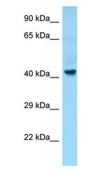 GPR34 antibody Western Blot of Fetal Brain.
