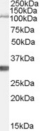 Antibody (1 ug/ml) staining of Mouse Brain lysate (35 ug protein in RIPA buffer). Primary incubation was 1 hour. Detected by chemiluminescence.