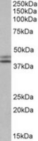 IDH1 antibody (0.1 ug/ml) staining of HepG2 lysate (35 ug protein/ml in RIPA buffer). Primary incubation was 1 hour. Detected by chemiluminescence.