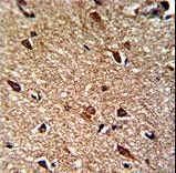Formalin-fixed and paraffin-embedded human brain reacted with IDH1 Antibody , which was peroxidase-conjugated to the secondary antibody, followed by DAB staining. This data demonstrates the use of this antibody for immunohistochemistry; clinical relevance has not been evaluated.