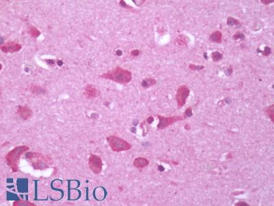 Human Brain, Cortex: Formalin-Fixed, Paraffin-Embedded (FFPE)