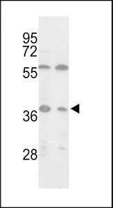 Western blot of Isocitrate dehydrogenase in MCF-7, Jurkat cell line lysates (35 ug/lane). Isocitrate dehydrogenase (arrow) was detected using the purified antibody.