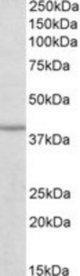IDH3B antibody (0.3 ug/ml) staining of Human Skeletal muscle lysate (35 ug protein/ml in RIPA buffer). Primary incubation was 1 hour. Detected by chemiluminescence.