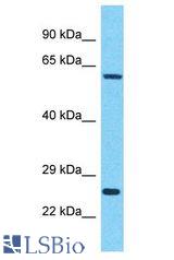 IDH3B antibody Western Blot of HepG2. Antibody dilution: 1 ug/ml.