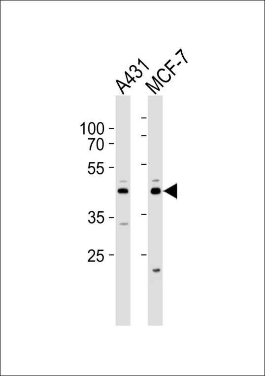 Western blot of lysates from A431, MCF-7 cell line (from left to right) with IDH3G Antibody. Antibody was diluted at 1:1000 at each lane. A goat anti-rabbit IgG H&L (HRP) at 1:5000 dilution was used as the secondary antibody. Lysates at 35 ug per lane.